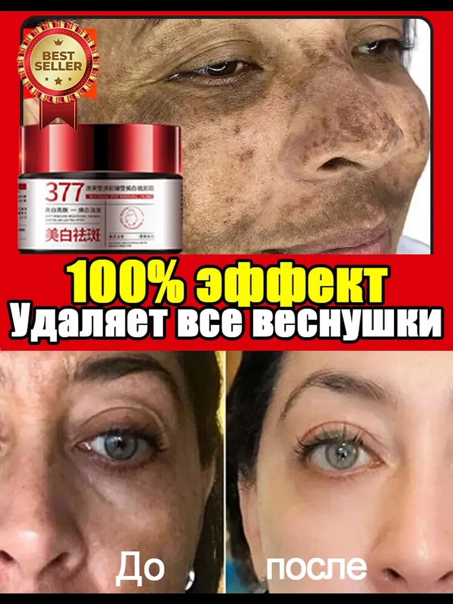 Сравнительный анализ: как избавиться от веснушек