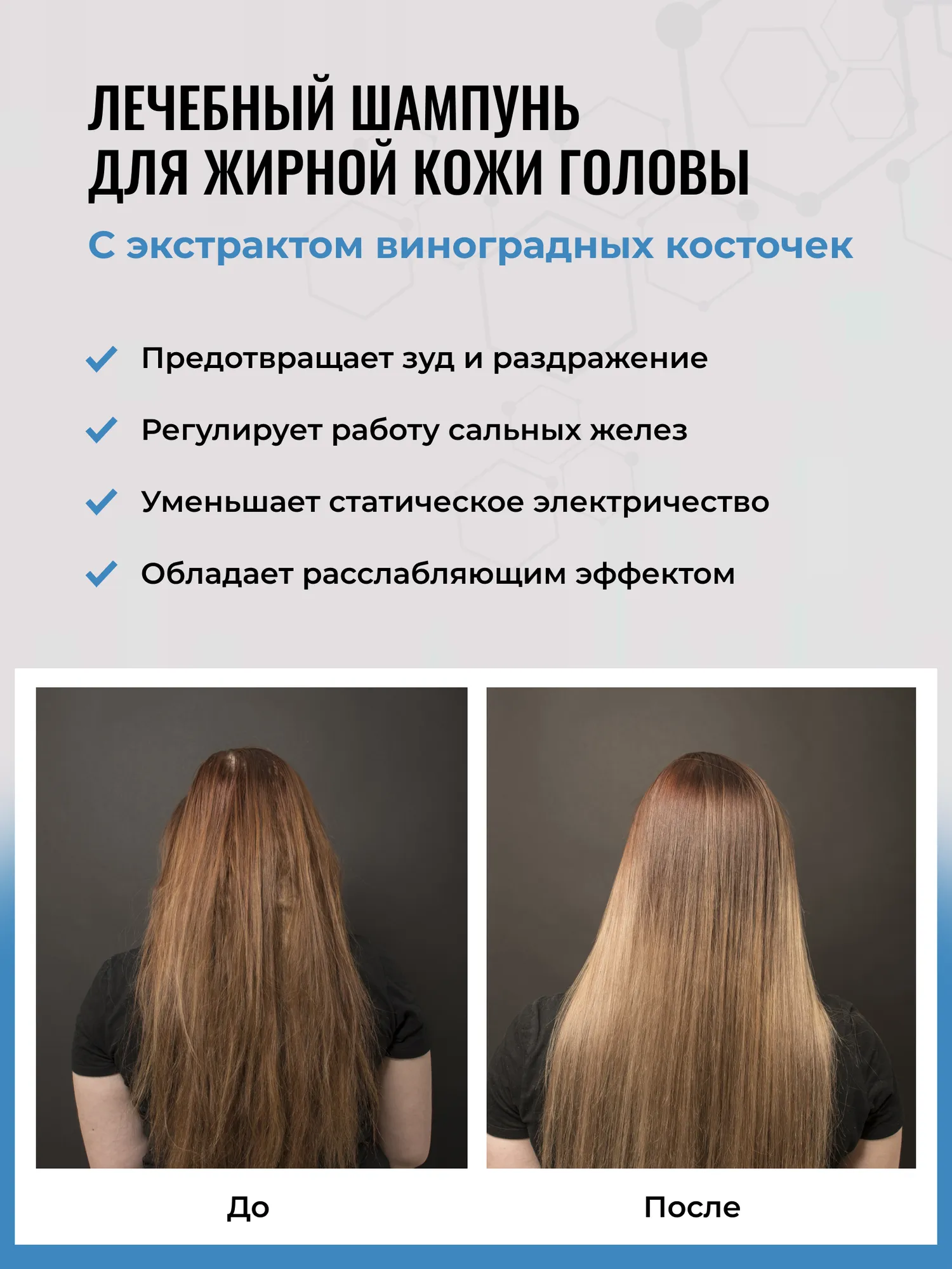 Актуальные новости: как избавиться от жирной кожи головы