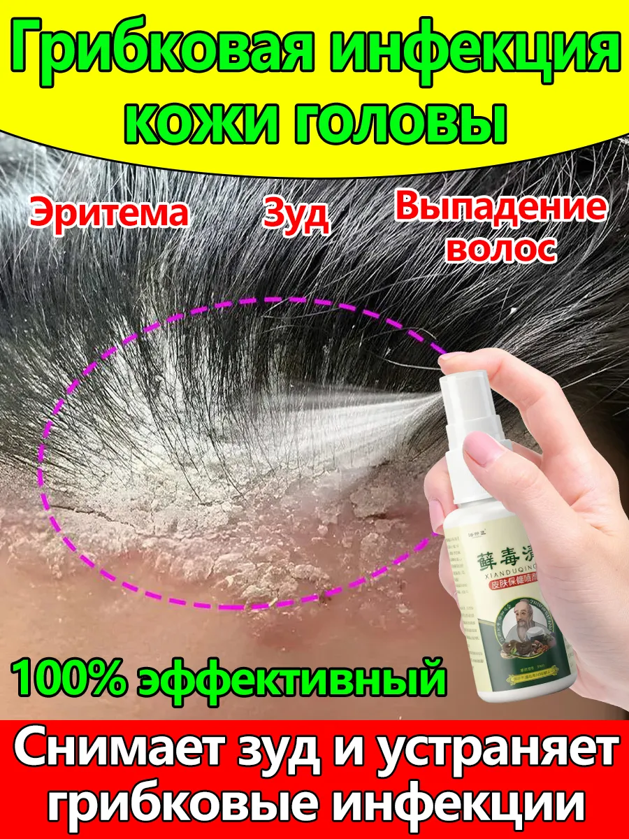 Визуальное объяснение: как избавиться от зуда кожи головы