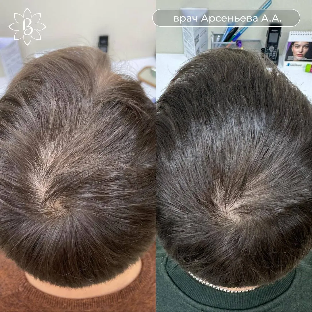 Современная клиника лечения волос: врач-трихолог проводит диагностику кожи головы пациента с помощью цифрового трихоскопа