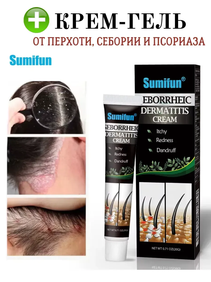 Сравнение здоровой кожи головы и кожи с признаками себорейного дерматита: покраснение, шелушение, методы лечения