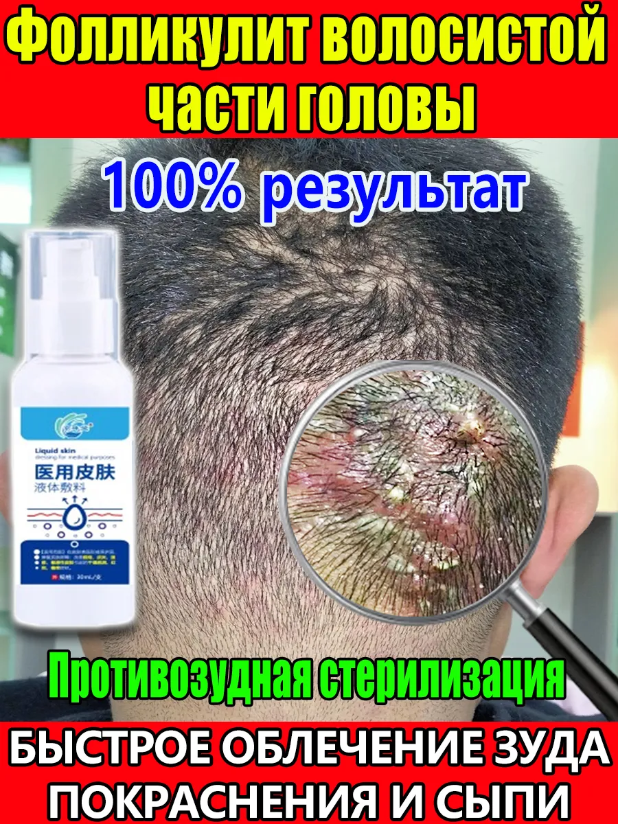 Натуральные народные средства от зуда головы: отвары трав, масла и маски на кухонном столе