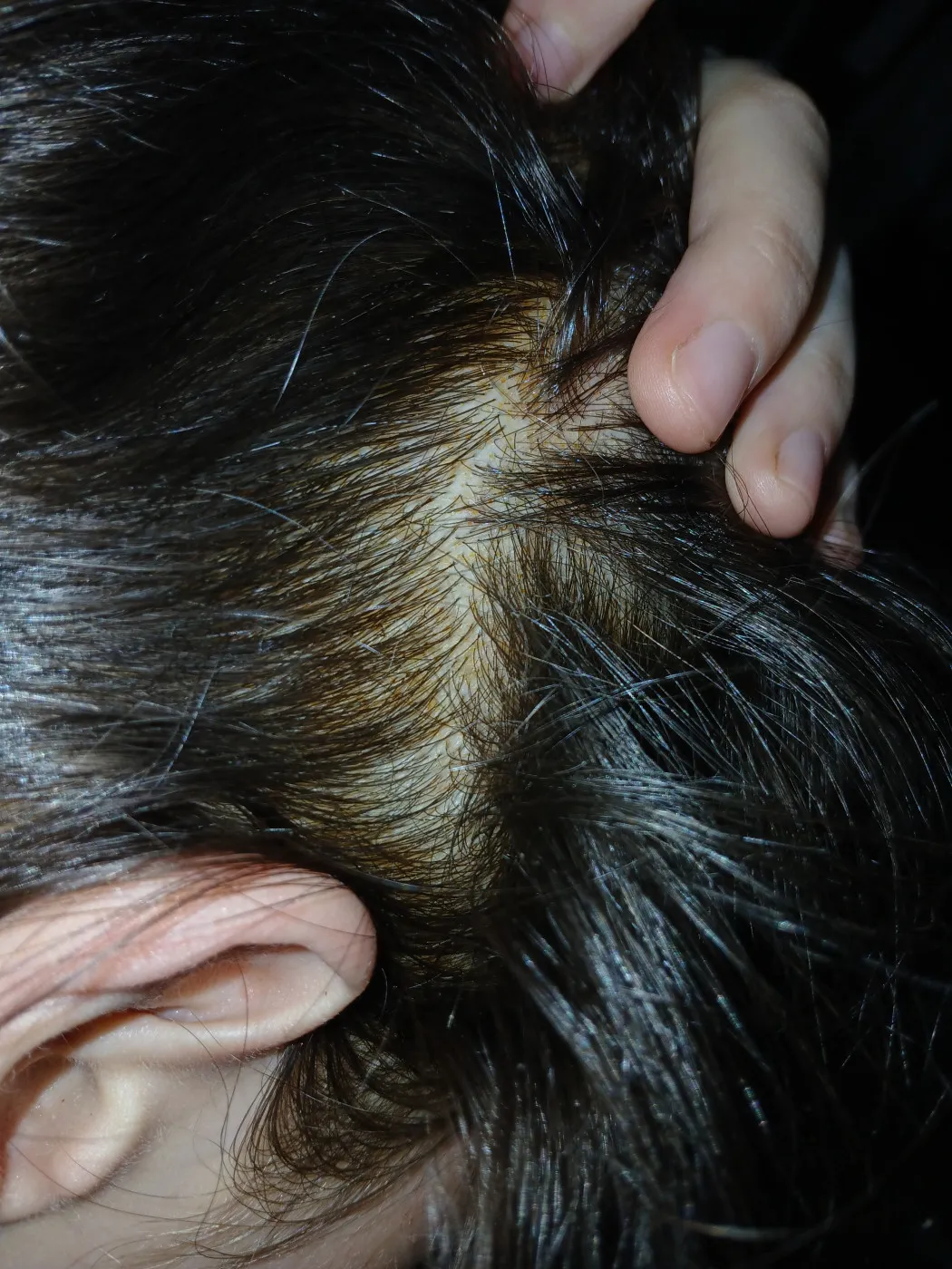 Визуальное руководство по: прядь волос выпала