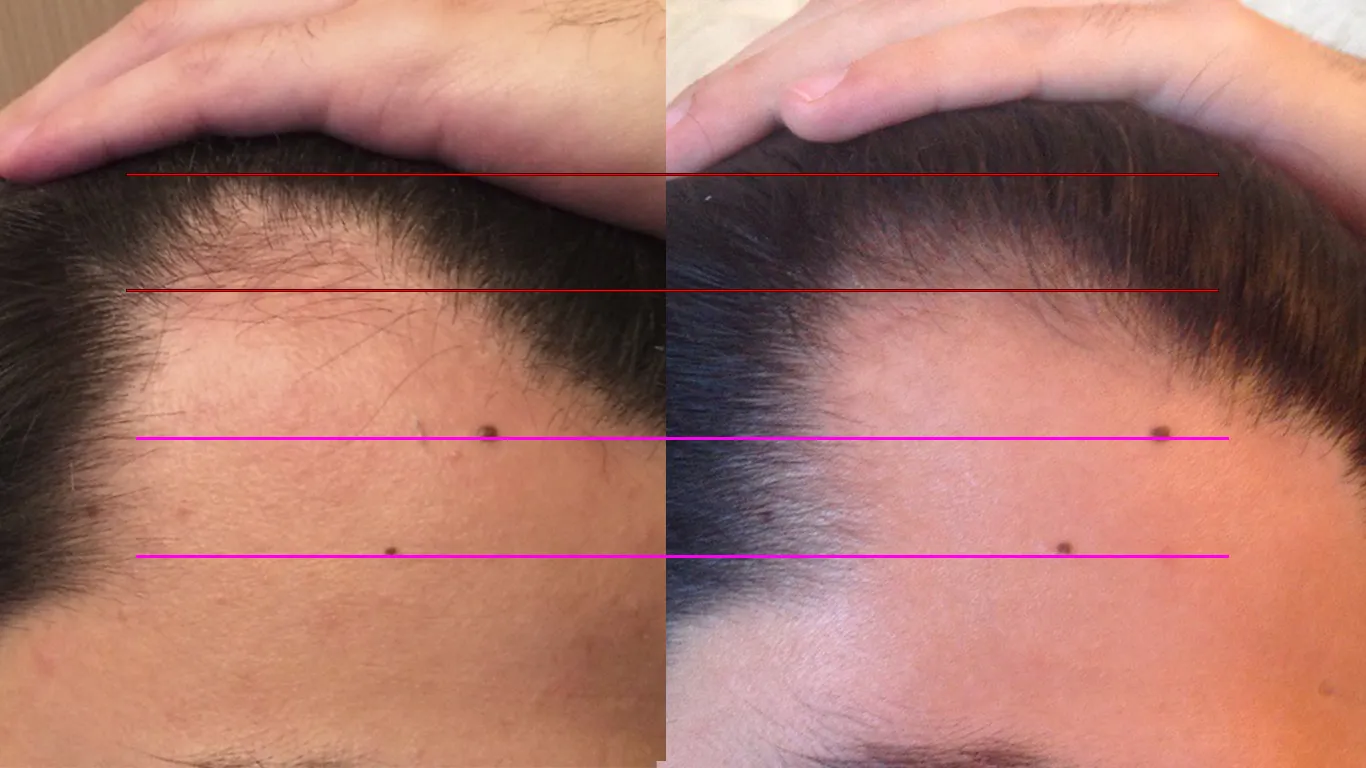 Визуальное объяснение: Рост волос у человека