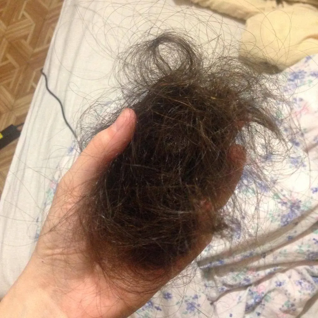 Визуальное руководство по: сильное выпадение волос причины