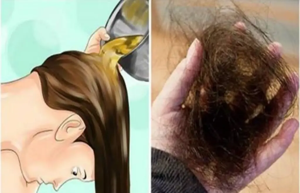 Блог Здоровье и медицина — Выпадение волос и щитовидная железа